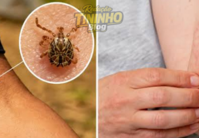 FEBRE MACULOSA: SAIBA QUAIS SÃO OS SINTOMAS, COMO OCORRE A TRANSMISSÃO E COMO SE PREVENIR